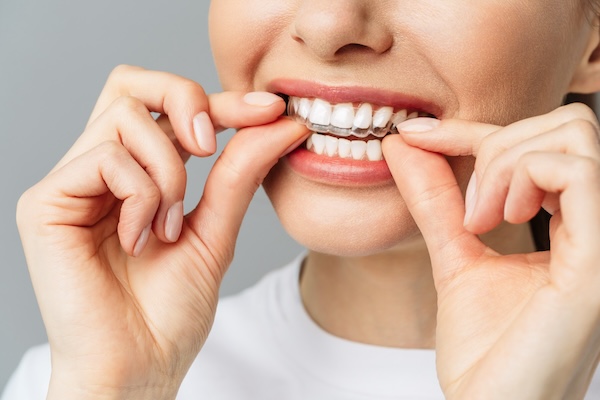 invisalign near you