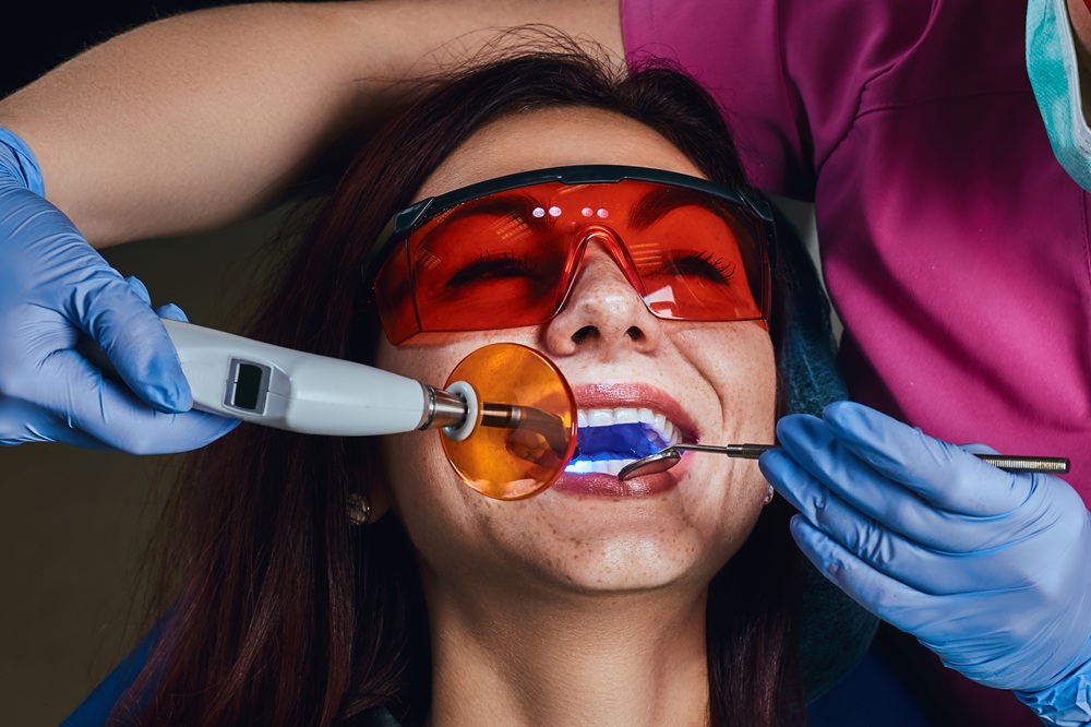 How Does Professional Teeth Whitening Work